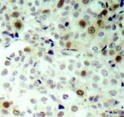 Immunohistochemistry-Paraffin: CDK2 [p Thr160] Antibody - Azide and BSA Free [NBP3-05409]